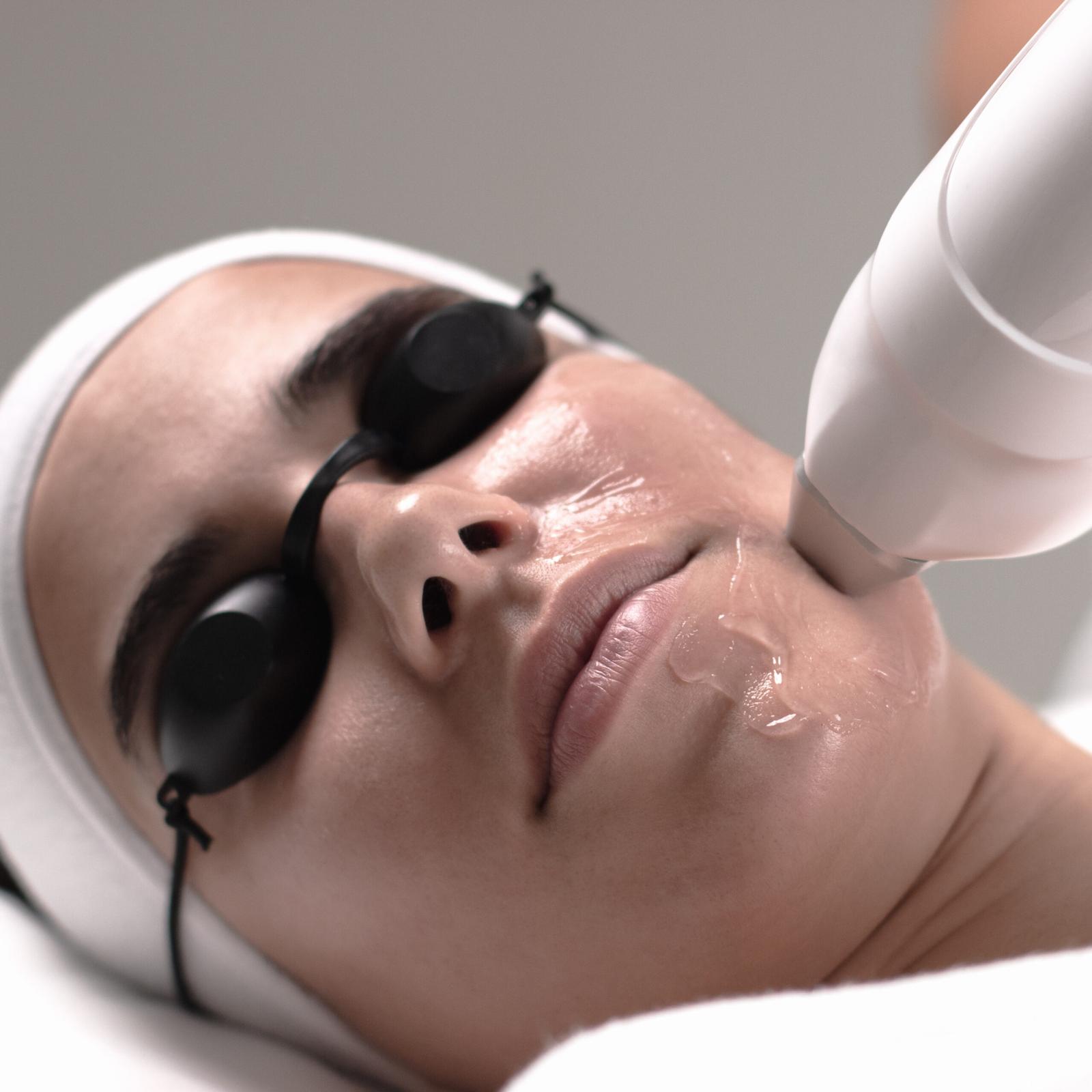 Tratamiento facial profesional